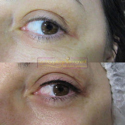 Réalisations yeux